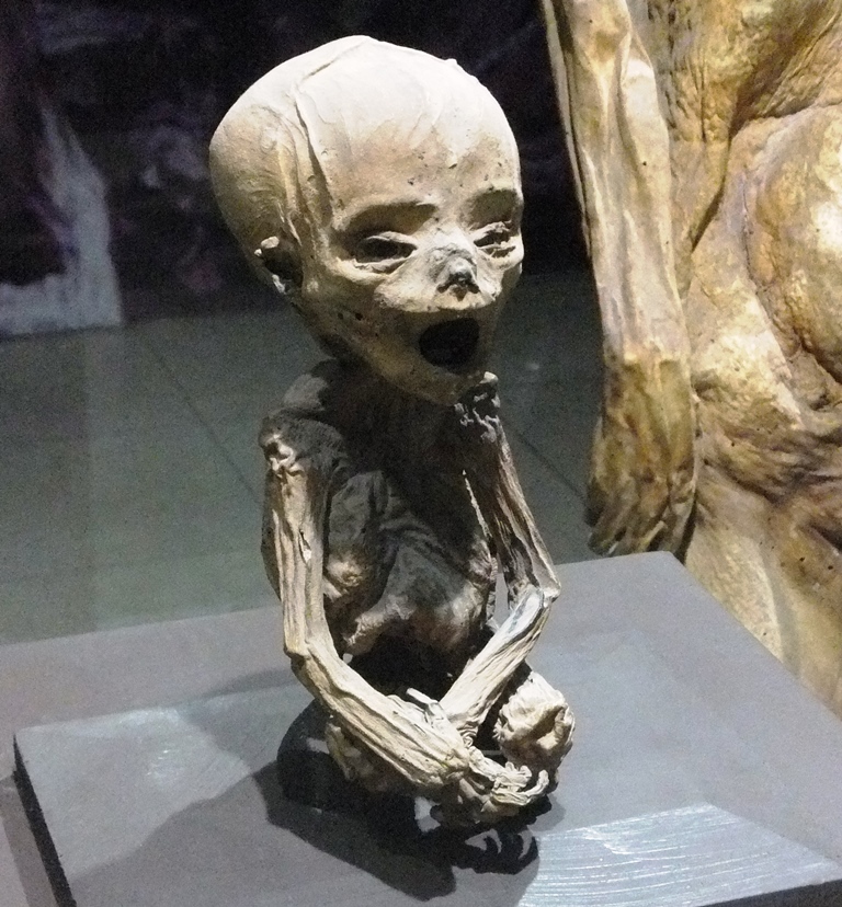World's smallest human mummy
